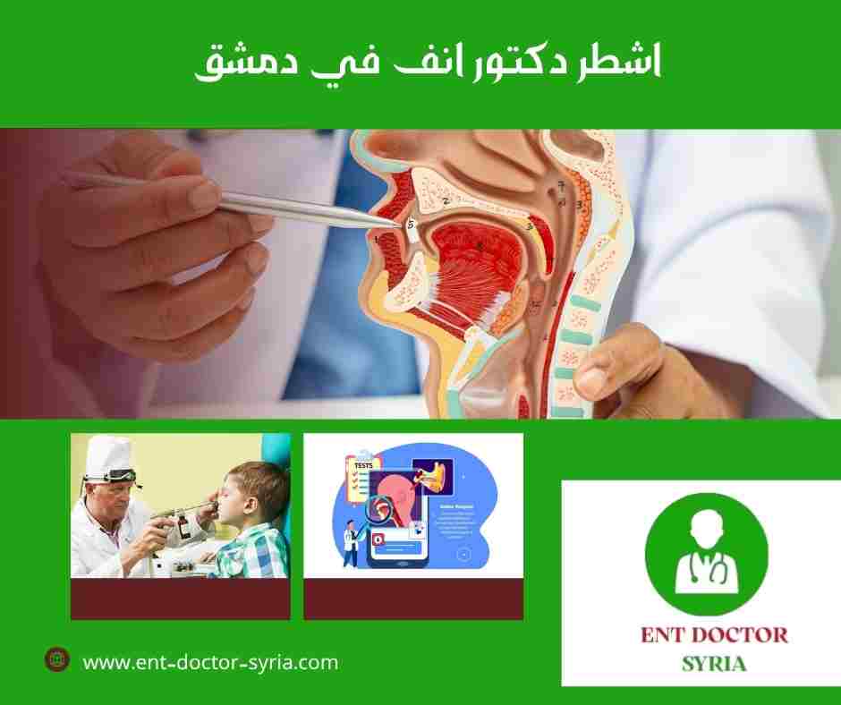اشطر دكتور انف في دمشق