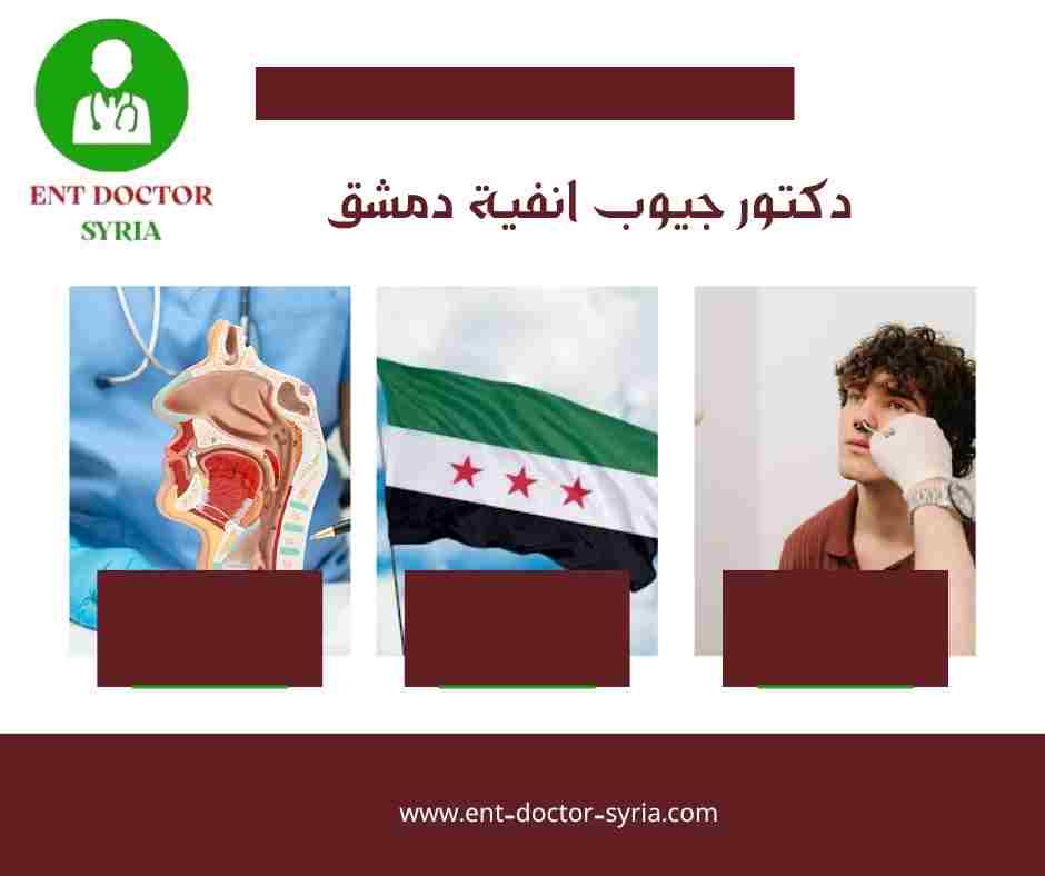 دكتور جيوب انفية دمشق