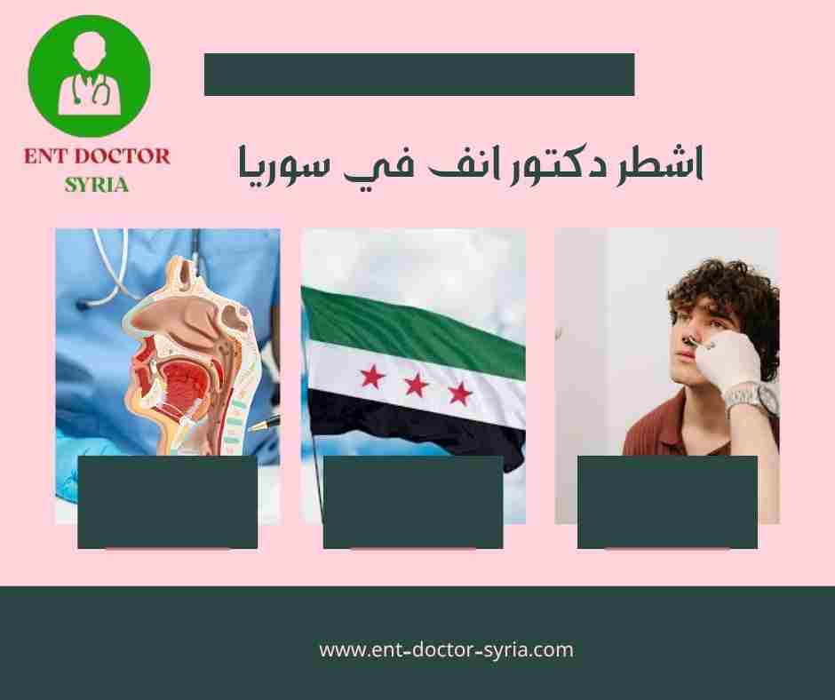 اشطر دكتور انف في سوريا