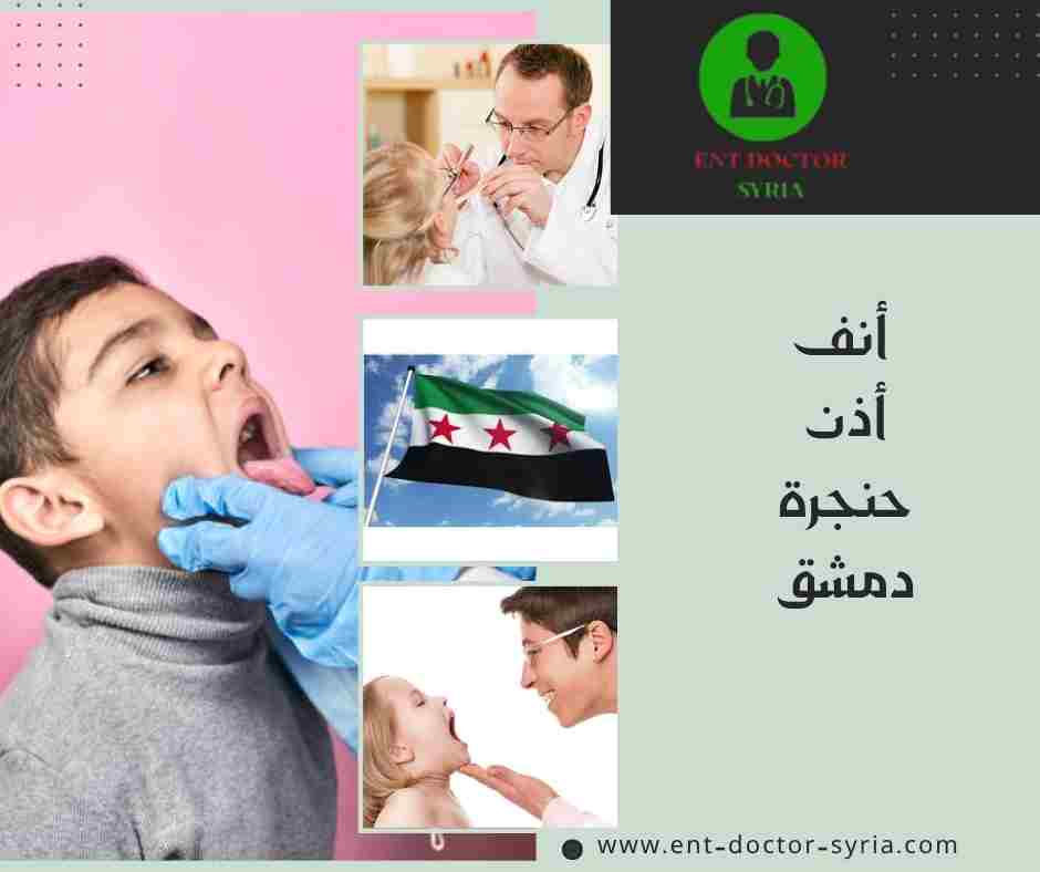 أنف أذن حنجرة دمشق