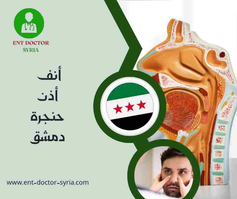 أنف أذن حنجرة دمشق