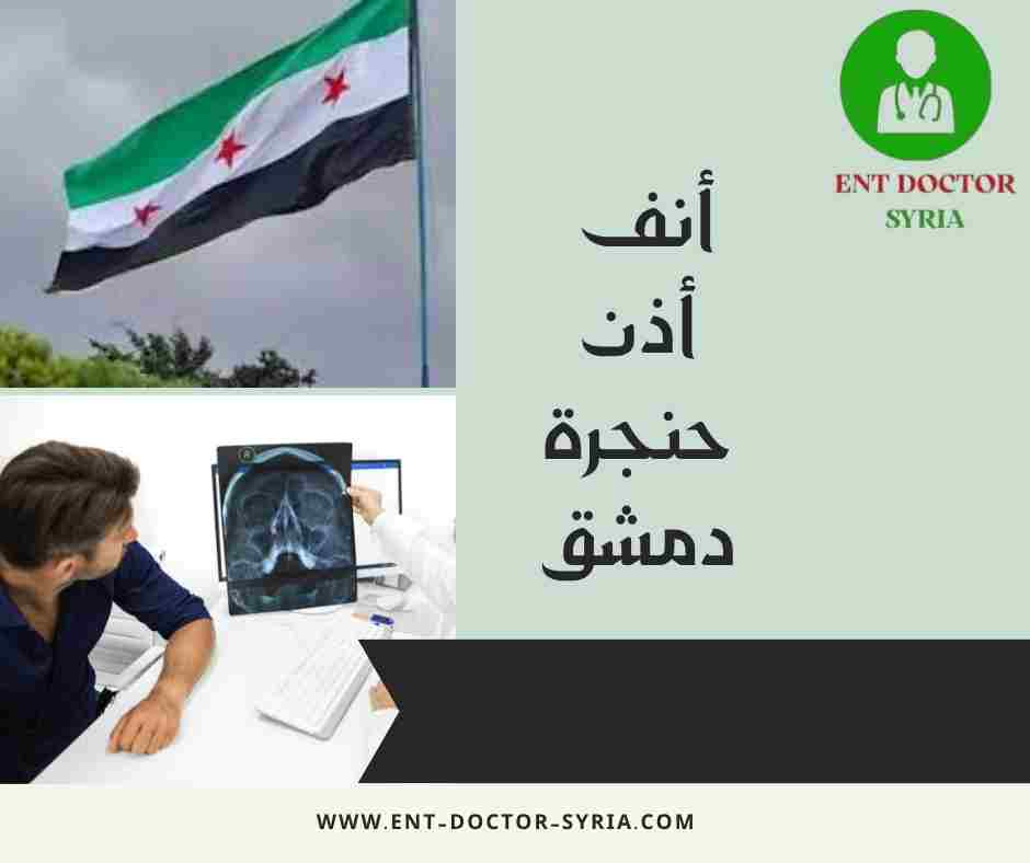 أنف أذن حنجرة دمشق