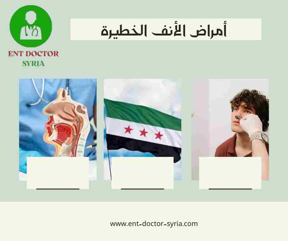 أمراض الأنف الخطيرة أمراض الأنف الخطيرة