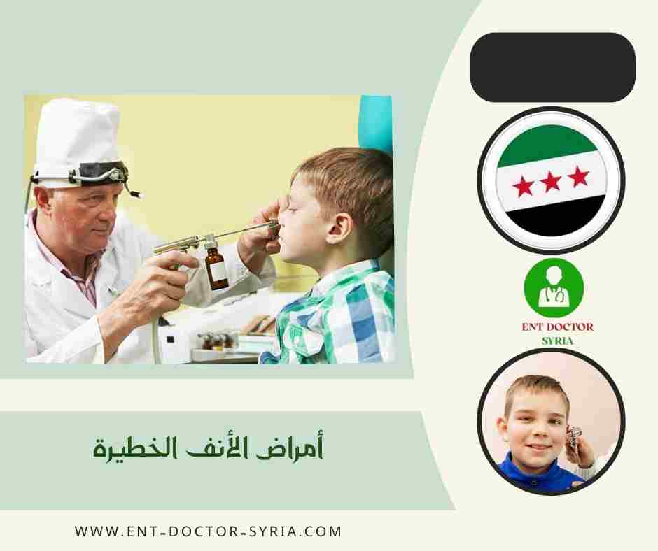 أمراض الأنف الخطيرة أمراض الأنف الخطيرة