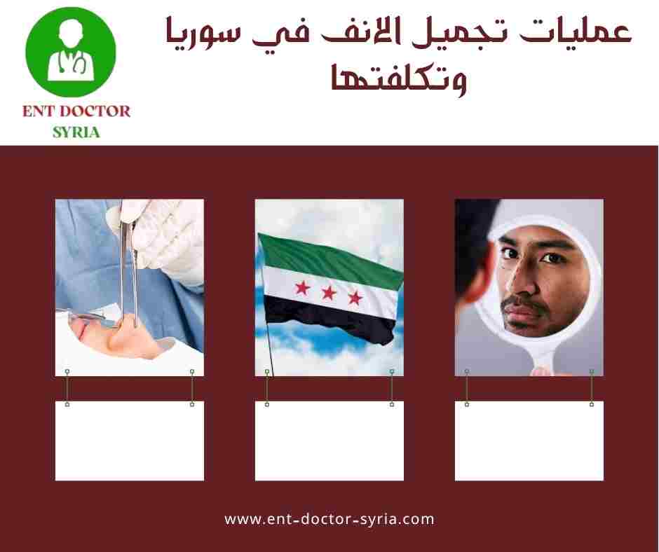 عمليات تجميل الانف في سوريا وتكلفتها