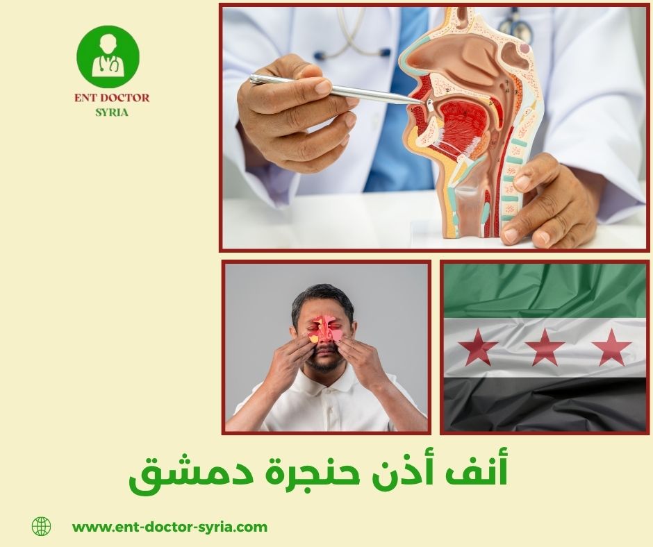 أنف أذن حنجرة دمشق
