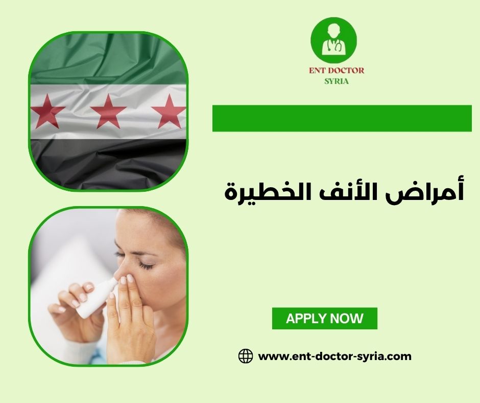 أمراض الأنف الخطيرة أمراض الأنف الخطيرة