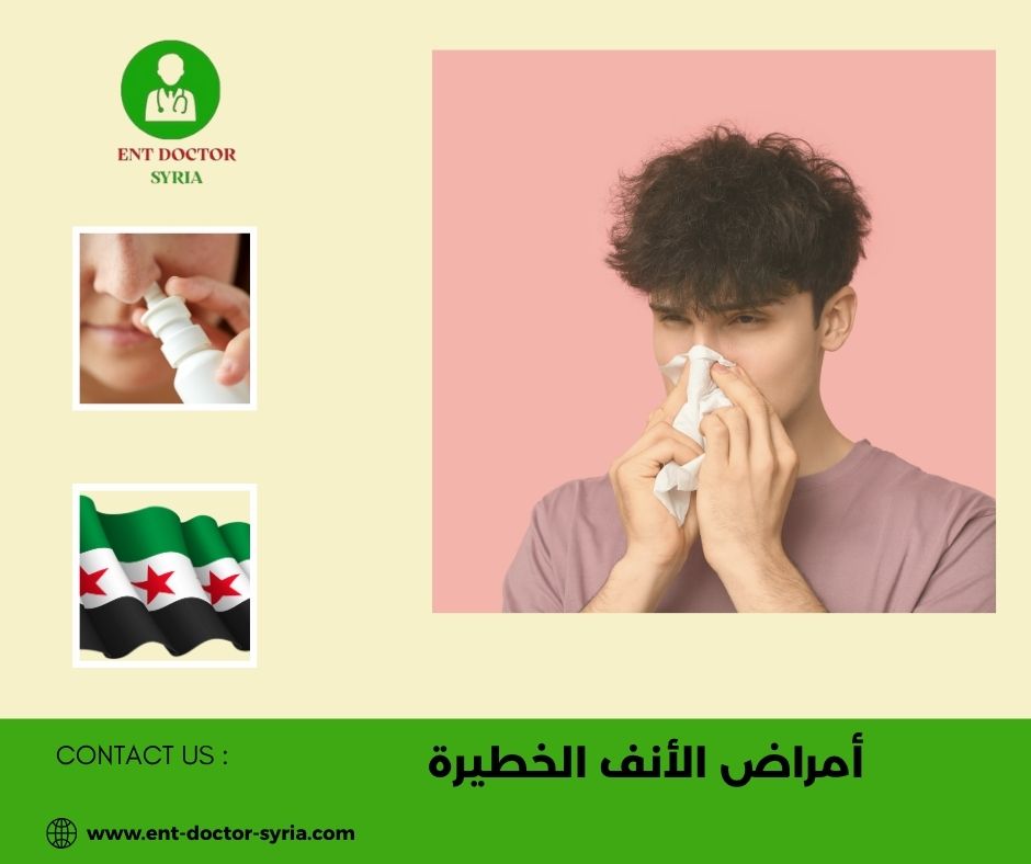 أمراض الأنف الخطيرة