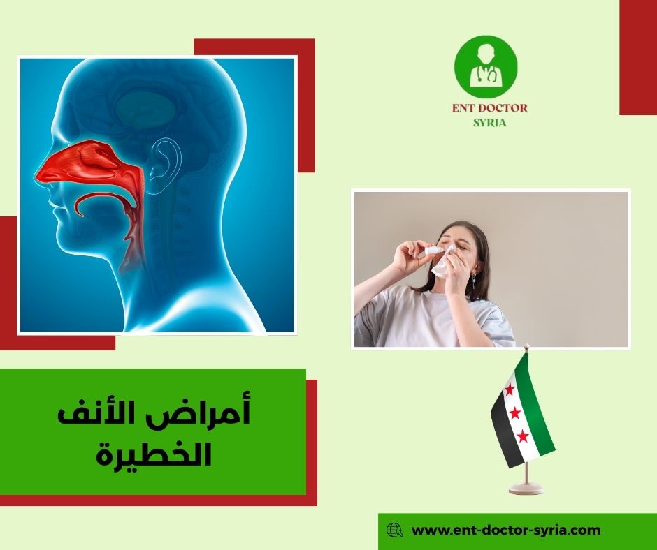 ألم في الأنف عند اللمس ألم في الأنف عند اللمس