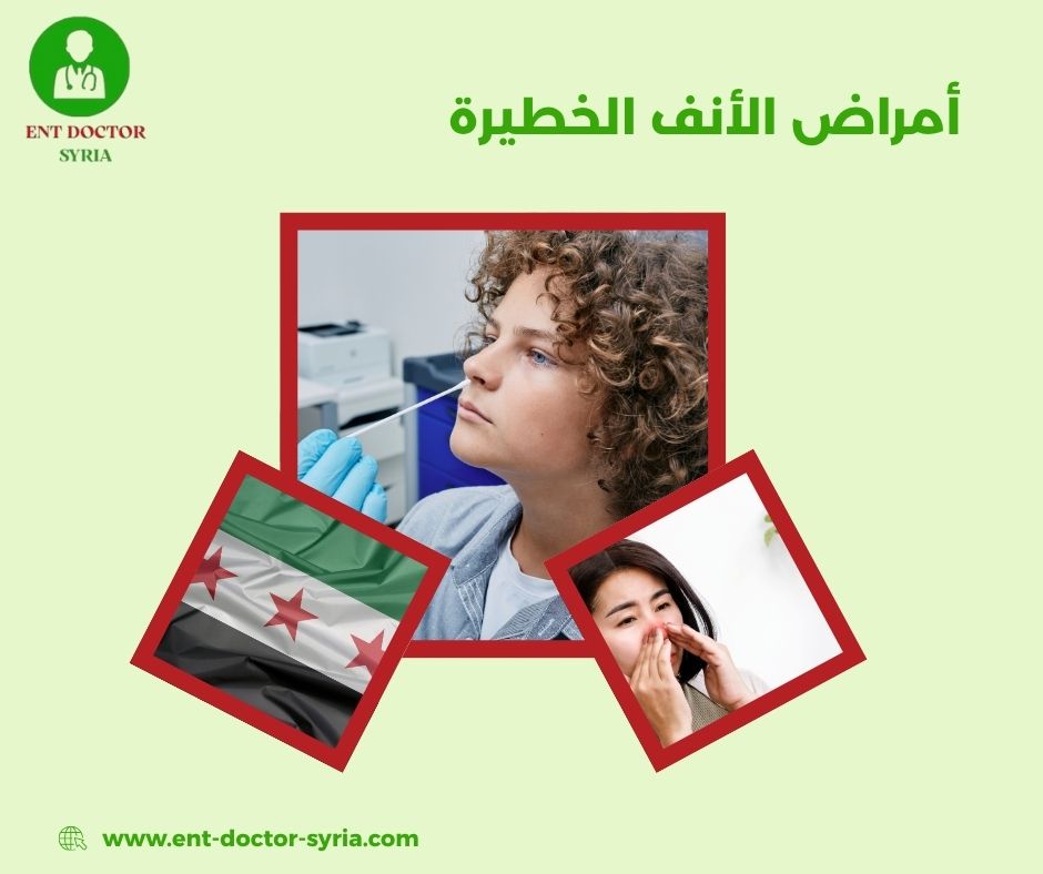 علاج التهاب الأنف من الداخل في المنزل علاج التهاب الأنف من الداخل في المنزل